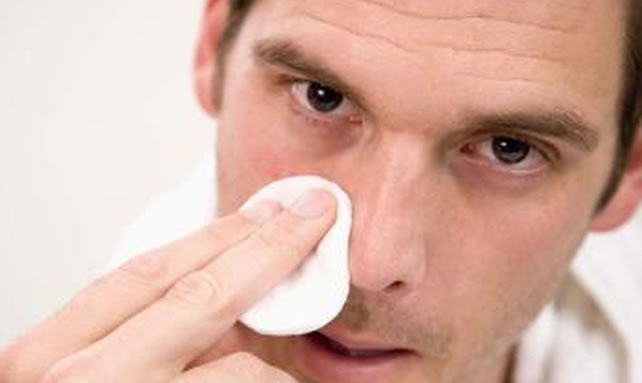 男性ですけどいちご鼻を治すにはどうしたらいいですか？